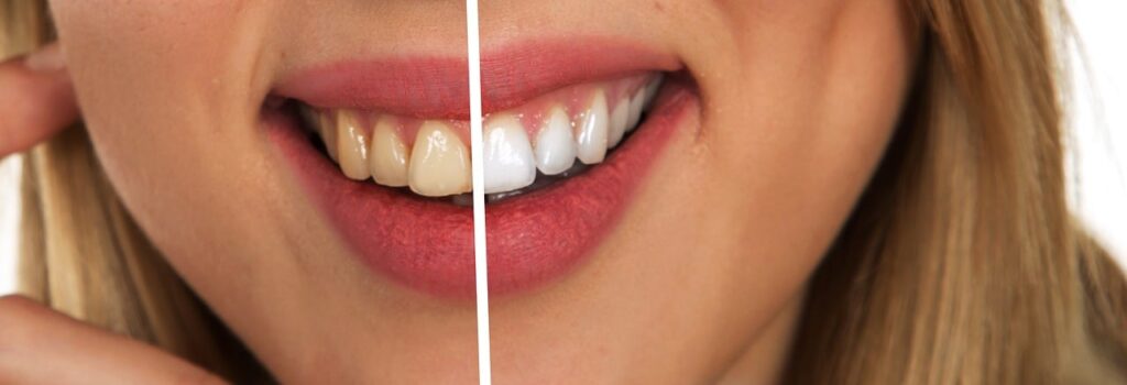 Mehr als nur ein Lächeln: Wie Zahngesundheit unseren Körper beeinflusst auf zahnpasta-tests.de